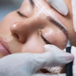 کاشت ابرو - کلینیک آتنوس